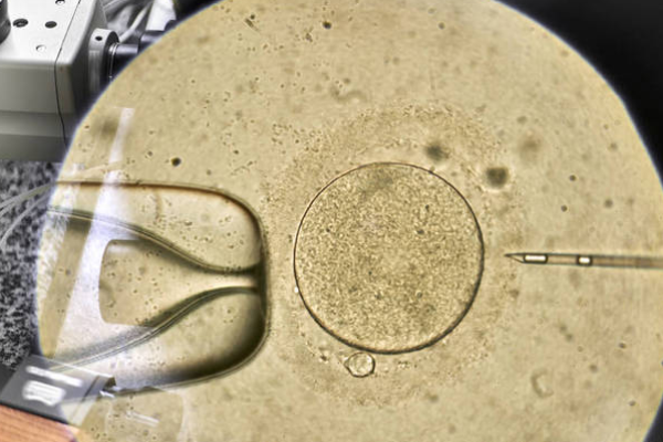 优贝健康UBABE格鲁吉亚试管婴儿中哪些情况适合胚胎冷冻