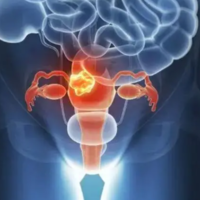 新生NewBorn格鲁吉亚试管婴儿如何提高受孕成功率呵护精子很关键