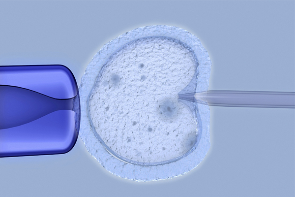 格鲁吉亚第三方生殖辅助的相关流程汇合一览正文高品质成熟的卵子健康的精子和优良的子宫是孕育的